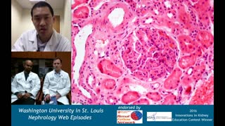 Web Episode #014 - Renal Pathology Series (Dr. Gaut and Dr. Venkatachalam)