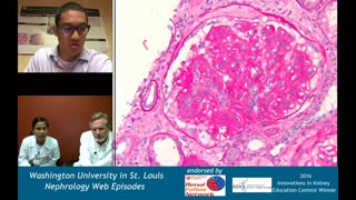 Nephrology Web Episode #021 - Renal Pathology Teaching Series (MPGN with Drs  Rodby and Charag)