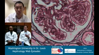Web Episode #015 - Renal Pathology Series - Diabetic Nephropathy (Dr. Gaut and Dr. Venkatachalam)