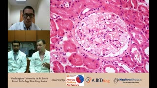 Web Episode #011 - Renal Pathology Teaching Series (Dr. Gaut and Dr. Younus)